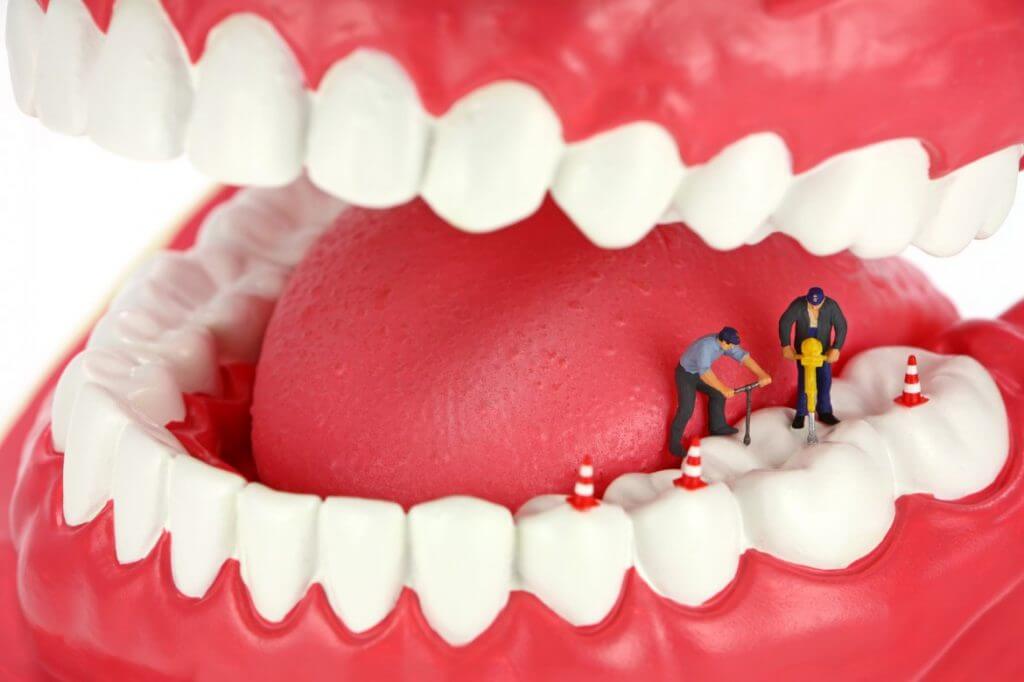کلینیک دندانپزشکی دانا آبسه حاد دندانی چيست؟