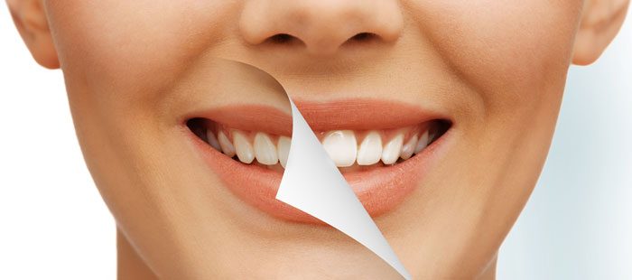 کلینیک دندانپزشکی دانا تفاوت سفید کردن دندان و بلیچینگ