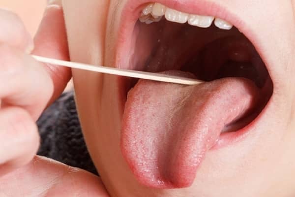کلینیک دندانپزشکی دانا دلایل خشکی دهان را بشناسید