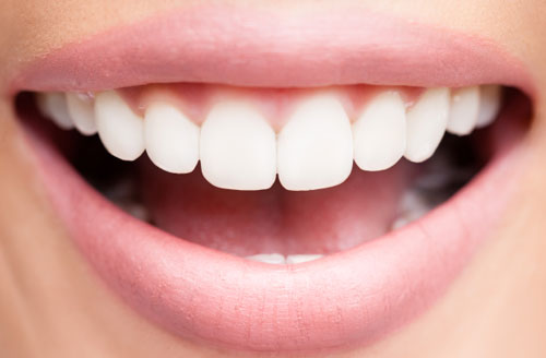 کلینیک دندانپزشکی دانا لمینیت چیست؟