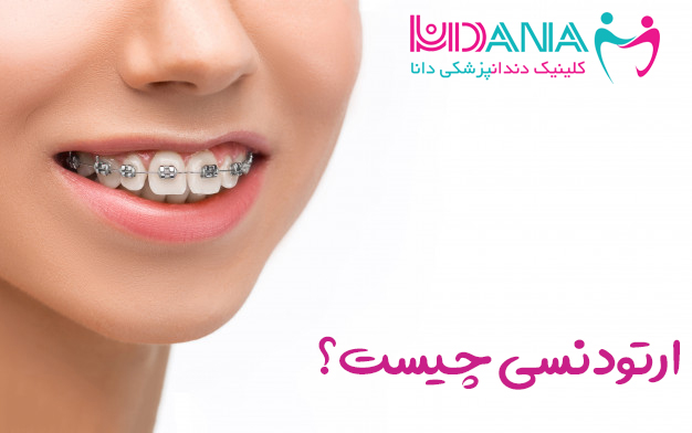 کلینیک دندانپزشکی دانا ارتودنسی چیست؟