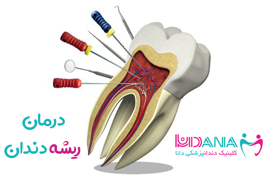 کلینیک دندانپزشکی دانا درمان ریشه دندان
