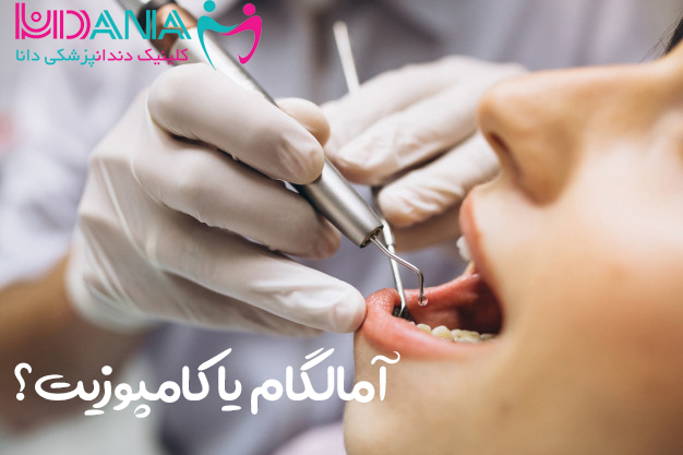 کلینیک دندانپزشکی دانا آمالگام یا کامپوزیت؟