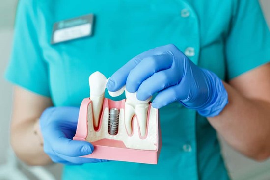 کلینیک دندانپزشکی دانا ایمپلنت فوری راهی سریع برای رسیدن به لبخندی جذاب